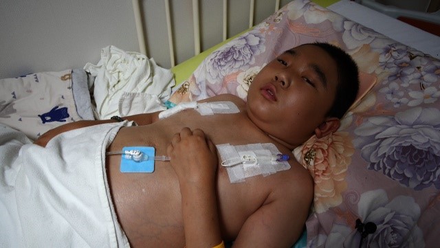 ▲3년 전 발병한 뇌종양으로 투병중인 열다섯 살 최기극 군 (사진제공