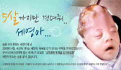 "세영아, 5살까지만 견뎌줘", 희망TV SBS에 방영된 세영이 이야기